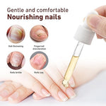 7 días de crecimiento y fortalecimiento de uñas suero 0.7 fl oz solución suavizante de onicomicosis aceite de tratamiento de uñas para uñas descoloridas y dañadas