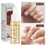 7 días de crecimiento y fortalecimiento de uñas suero 0.7 fl oz solución suavizante de onicomicosis aceite de tratamiento de uñas para uñas descoloridas y dañadas